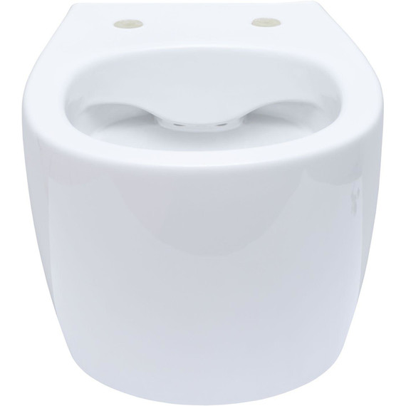 Унитаз приставной безободковый Allen Brau Fantasy 4.11004.20 с тонкой крышкой микролифт фото 2