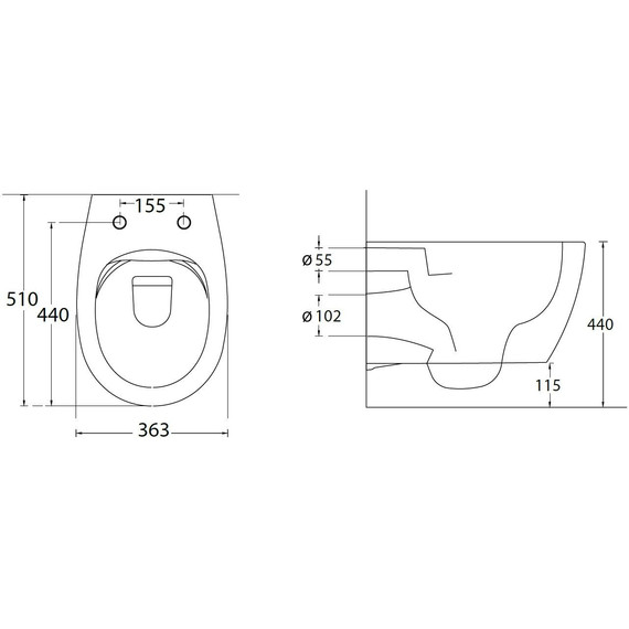 Унитаз-биде подвесной безободковый Allen Brau Fantasy 4.11HC1.20 с тонкой крышкой микролифт фото 36