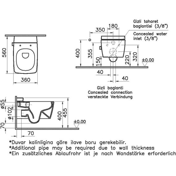 Унитаз-биде подвесной безободковый Vitra Metropole 7672B003-1687 фото 8
